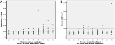 Conduction Block and Nerve Cross-Sectional Area in Multifocal Motor Neuropathy